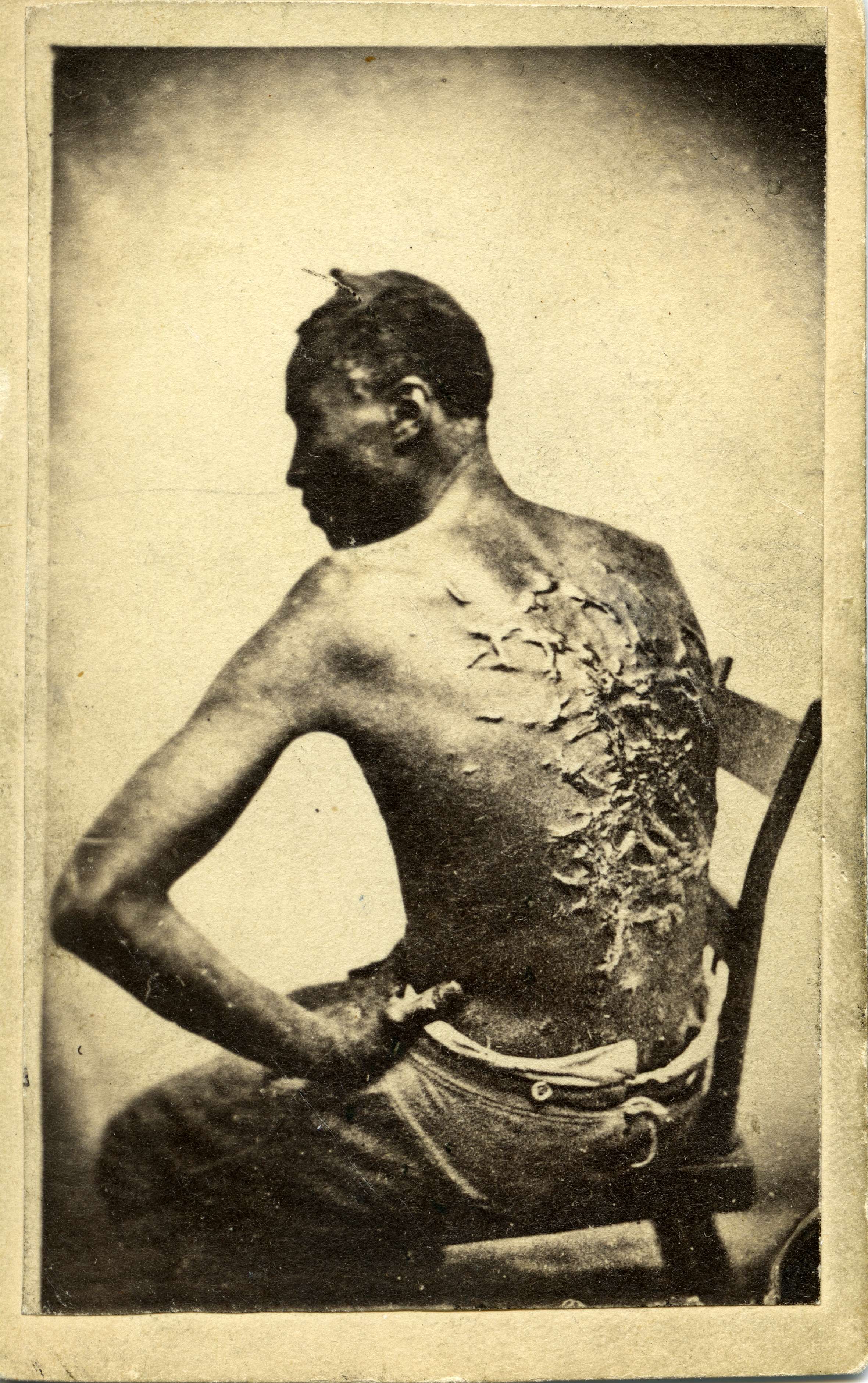 Photograph of Peter, a formerly enslaved man
